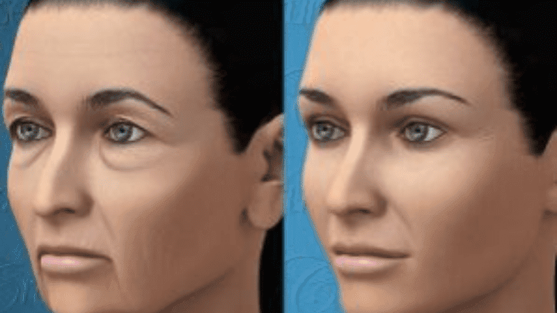 Untitled design (22)